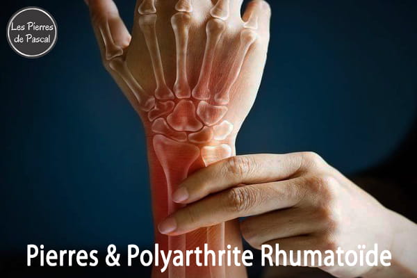 Polyarthrite Rhumatoïde : Les Meilleures Pierres pour Soulager Naturellement | Par Pascal Artisan
