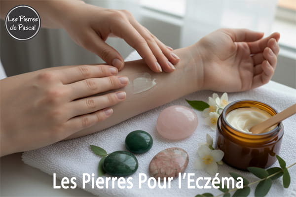 Article de blog "Eczéma : Les Pierres pour Apaiser, Cicatriser et Retrouver une Peau Sereine | Par Pascal Artisan"